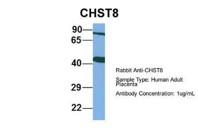 Western Blot: CHST8 Antibody [NBP1-69273] - Human Adult Placenta, Antibody Dilution: 1.0 ug/ml.