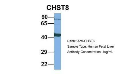 Western Blot: CHST8 Antibody [NBP1-69273] - Human Fetal Liver, Antibody Dilution: 1.0 ug/ml.