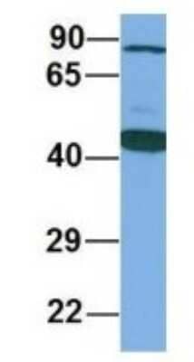 Western Blot: CHST8 Antibody [NBP1-69273] - Human Fetal Lung, Antibody Dilution: 1.0 ug/ml.