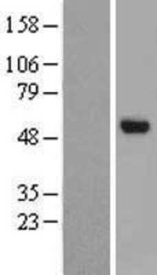 Western Blot: CHST8 Overexpression Lysate (Adult Normal) [NBL1-09198] Left-Empty vector transfected control cell lysate (HEK293 cell lysate); Right -Over-expression Lysate for CHST8.