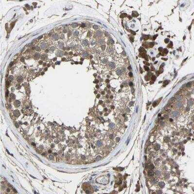 Immunohistochemistry-Paraffin CHST9 Antibody