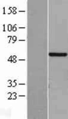 Western Blot CHST9 Overexpression Lysate