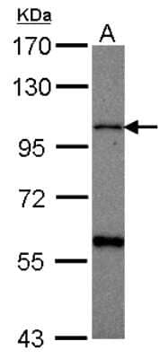 Western Blot: CHSY1 Antibody [NBP2-15899] - Sample (30 ug of whole cell lysate) A: HeLa 7. 5% SDS PAGE gel, diluted at 1:500.