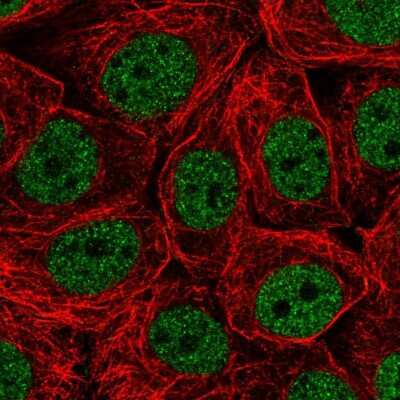 Immunocytochemistry/Immunofluorescence: CHTF18 Antibody [NBP2-55371] - Staining of human cell line MCF7 shows localization to nucleoplasm.