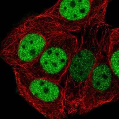 Immunocytochemistry/Immunofluorescence: CHTF18 Antibody [NBP2-58935] - Staining of human cell line MCF7 shows localization to nucleoplasm.