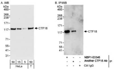 Western Blot: CHTF18 Antibody [NBP1-03346] - Whole cell lysate from HeLa (5, 15 and 50 mcg for WB; 1 mg for IP, 20% of IP loaded) and 293T (T; 50 mcg) cells. NBP1-03346 used for WB at 0.04 mcg/ml (A) and 1 mcg/ml (B) and used for IP at 3 mcg/mg lysate.