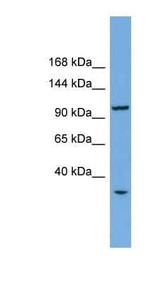 Western Blot: CHTF18 Antibody [NBP1-57605] - Human Liver cell lysate, concentration 0.2-1 ug/ml.