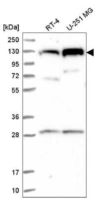 Western Blot: CHTF18 Antibody [NBP2-58935] - Western blot analysis in human cell line RT-4 and human cell line U-251 MG.