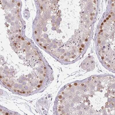 Immunohistochemistry-Paraffin CHTF8 Antibody