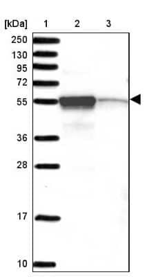 Western Blot CHTF8 Antibody