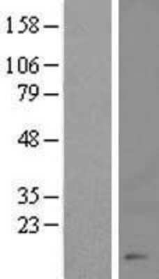 Western Blot: CHTF8 Overexpression Lysate (Adult Normal) [NBL1-09571] Left-Empty vector transfected control cell lysate (HEK293 cell lysate); Right -Over-expression Lysate for CHTF8.