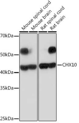 Western Blot: CHX10 Antibody (4Z4R2) [NBP3-15945] - Western blot analysis of extracts of various cell lines, using CHX10 Rabbit mAb (NBP3-15945) at 1:1000 dilution. Secondary antibody: HRP Goat Anti-Rabbit IgG (H+L) at 1:10000 dilution. Lysates/proteins: 25ug per lane. Blocking buffer: 3% nonfat dry milk in TBST. Detection: ECL Basic Kit. Exposure time: 180s.