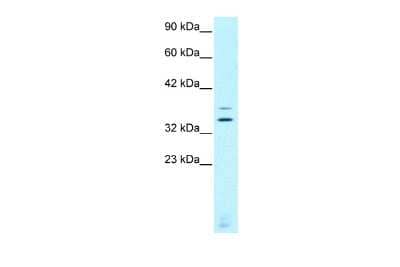 Western Blot: CHX10 Antibody [NBP2-84680] - WB Suggested Anti-CHX10 Antibody Titration: 0.2-1 ug/ml. ELISA Titer: 1:12500. Positive Control: Jurkat cell lysate