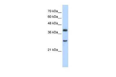 Western Blot: CIAO1 Antibody [NBP2-84681] - WB Suggested Anti-WDR39 Antibody Titration: 2.5ug/ml. Positive Control: Jurkat cell lysateCIAO1 is supported by BioGPS gene expression data to be expressed in Jurkat