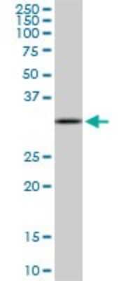 Western Blot: CIAPIN1 Antibody (5G8) [H00057019-M01] - CIAPIN1 monoclonal antibody (M01), clone 5G8. Analysis of CIAPIN1 expression in PC-12.