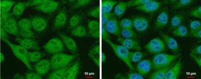 Immunocytochemistry/ Immunofluorescence CIAPIN1 Antibody - BSA Free