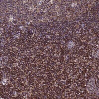 Immunohistochemistry-Paraffin CIAPIN1 Antibody - BSA Free