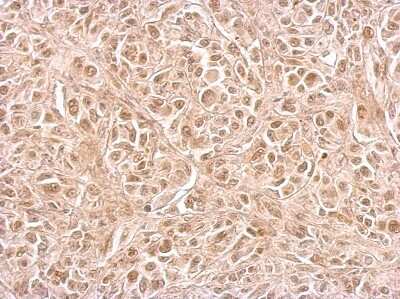 Immunohistochemistry-Paraffin CIAPIN1 Antibody - BSA Free