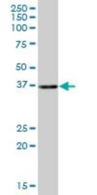 Western Blot: CIAPIN1 Antibody [H00057019-B01P] - Analysis of CIAPIN1 expression in human pancreas.