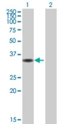 Western Blot: CIAPIN1 Antibody [H00057019-B01P] - Analysis of CIAPIN1 expression in transfected 293T cell line by CIAPIN1 polyclonal antibody.  Lane 1: CIAPIN1 transfected lysate(34.32 KDa). Lane 2: Non-transfected lysate.