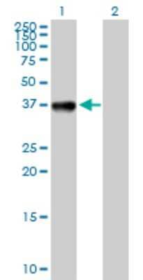 Western Blot: CIAPIN1 Antibody [H00057019-D01P] - Analysis of CIAPIN1 expression in transfected 293T cell line by CIAPIN1 polyclonal antibody.Lane 1: CIAPIN1 transfected lysate(33.60 KDa).Lane 2: Non-transfected lysate.
