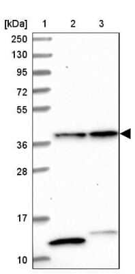 Western Blot CIAPIN1 Antibody - BSA Free