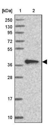 Western Blot CIAPIN1 Antibody - BSA Free