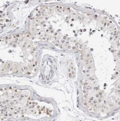 Immunohistochemistry-Paraffin: CIART Antibody [NBP1-88685] - Immunohistochemical staining of human testis shows moderate nuclear positivity in a subset of cells in seminiferous ducts.