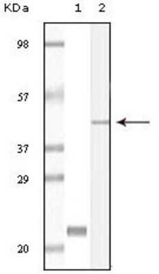 Western Blot: CIB1 Antibody (5A1F5E12) [NBP1-47401] - Analysis using CIB1 mouse mAb against truncated CIB1 recombinant protein (1) and A431 cell lysate (2).