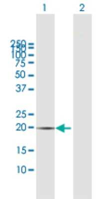 Western Blot: CIB1 Antibody [H00010519-B01P] - Analysis of CIB1 expression in transfected 293T cell line by CIB1 polyclonal antibody.  Lane 1: CIB1 transfected lysate(21.01 KDa). Lane 2: Non-transfected lysate.