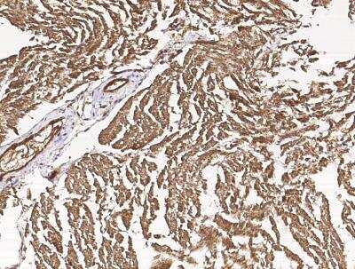 Immunohistochemistry-Paraffin: CIB2 Antibody (001) [NBP2-90129] - Staining of human CIB2 in human heart with rabbit monoclonal antibody (1:2000).