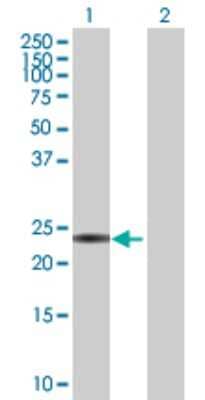 Western Blot: CIDEA Antibody [H00001149-D01P] - Analysis of CIDEA expression in transfected 293T cell line by CIDEA polyclonal antibody.Lane 1: CIDEA transfected lysate(28.30 KDa).Lane 2: Non-transfected lysate.