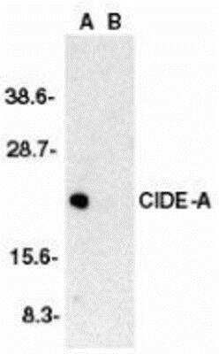 Western Blot: CIDEA Antibody [NBP1-76951] - Human brain tissue lysate in the absence (A) or presence (B) of peptide (2085P) with CIDE-A antibody at 1:2000 dilution.