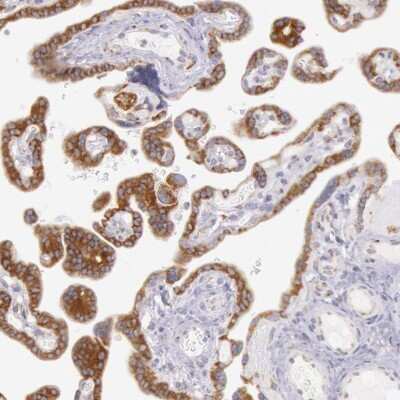 Immunohistochemistry-Paraffin CIDEB Antibody - BSA Free