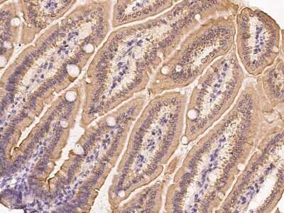 Immunohistochemistry-Paraffin: CIDEB Antibody [NBP2-99269] - Immunochemical staining of mouse CIDEB in mouse small intestine with rabbit polyclonal antibody at 1:300 dilution, formalin-fixed paraffin embedded sections.