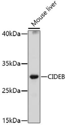 Western Blot: CIDEB Antibody [NBP2-92348] - Analysis of extracts of mouse liver, using CIDEB at 1:1000 dilution.Secondary antibody: HRP Goat Anti-Rabbit IgG (H+L) at 1:10000 dilution.Lysates/proteins: 25ug per lane.Blocking buffer: 3% nonfat dry milk in TBST.Detection: ECL Basic Kit .Exposure time: 30s.