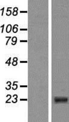 Western Blot CIDEB Overexpression Lysate