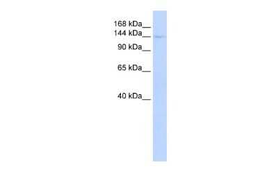 Western Blot: CIITA Antibody [NBP3-10468] - Western blot analysis using NBP3-10468 on Human Liver  as a positive control. Antibody Titration: 0.2-1 ug/ml