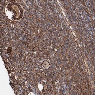 Immunohistochemistry-Paraffin: CILP-1 Antibody [NBP1-81667] - Staining of human Ovary shows strong positivity in extracellular matrix in follicle cells and stromal cells.