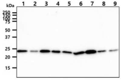 Western Blot: CINP Antibody (1G10) [NBP2-59486] - Lane 1: Jurkat cell lysates, Lane 2: K562 cell lysates, Lane 3: 293T cell lysates, Lane 4: HepG2 cell lysates, Lane 5: A549 cell lysates, Lane 6: MCF7 cell lysates, Lane 7: LnCap cell lysates, Lane 8: HeLa cell lysates, Lane 9: SK-OV-3 cell lysates