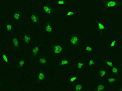 Immunocytochemistry/Immunofluorescence: CINP Antibody [NBP2-99270] - Immunofluorescence staining of CINP in HeLa cells. Cells were fixed with 4% PFA, permeabilzed with 0.1% Triton X-100 in PBS, blocked with 10% serum, and incubated with rabbit anti-Human CINP polyclonal antibody (dilution ratio 1:500) at 4C overnight. Then cells were stained with the Alexa Fluor(R)488-conjugated Goat Anti-rabbit IgG secondary antibody (green). Positive staining was localized to .