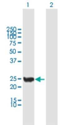 Western Blot: CINP Antibody [H00051550-B01P] - Analysis of CINP expression in transfected 293T cell line by CINP polyclonal antibody.  Lane 1: CINP transfected lysate(23.32 KDa). Lane 2: Non-transfected lysate.