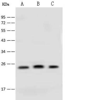 Western Blot: CINP Antibody [NBP2-99270] - Lane A: Jurkat Whole Cell LysateLane B: HeLa Whole Cell LysateLane C: MCF7 Whole Cell LysateLysates/proteins at 30 ug per lane.SecondaryGoat Anti-Rabbit IgG (H+L)/HRP at 1/10000 dilution.Developed using the ECL technique.Performed under reducing conditions.Predicted band size:24 kDaObserved band size:24 kDa