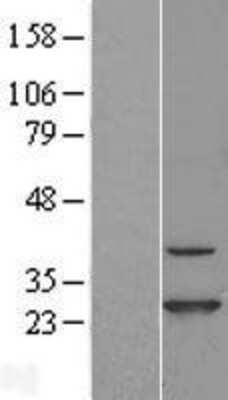 Western Blot: CINP Overexpression Lysate (Adult Normal) [NBL1-09209] Left-Empty vector transfected control cell lysate (HEK293 cell lysate); Right -Over-expression Lysate for CINP.
