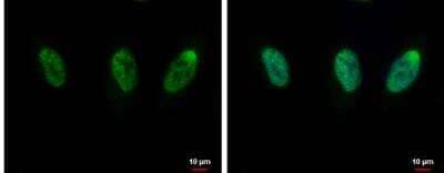 Immunocytochemistry/Immunofluorescence: CIP29 Antibody [NBP1-32511] - HeLa cells were fixed in 4% paraformaldehyde at RT for 15 min. Green: CIP29 protein stained by CIP29 antibody [N1C3] diluted at 1:1000. Blue: Hoechst 33342 staining.