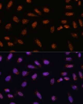 Immunocytochemistry/Immunofluorescence: CIP29 Antibody [NBP2-92120] - Analysis of U-2 OS cells using CIP29 at dilution of 1:100. Blue: DAPI for nuclear staining.