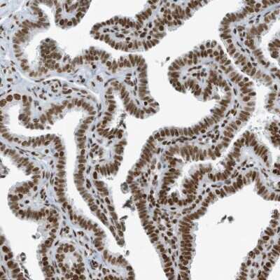Immunohistochemistry-Paraffin: CIP29 Antibody [NBP1-88084] - Staining of human fallopian tube shows strong nuclear positivity in glandular cells.