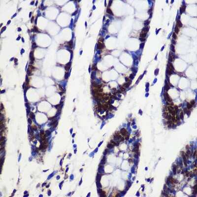 Immunohistochemistry-Paraffin: CIP29 Antibody [NBP2-92120] - Immunohistochemistry of paraffin-embedded Human colon using CIP29 Rabbit pAb (NBP2-92120) at dilution of 1:100 (40x lens). Perform microwave antigen retrieval with 10 mM PBS buffer pH 7.2 before commencing with IHC staining protocol.