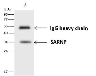 Immunoprecipitation: CIP29 Antibody [NBP2-97653] - CIP29 was immunoprecipitated using: Lane A: 0.5 mg Jurkat Whole Cell Lysate 4 ul anti-CIP29 rabbit polyclonal antibody and 60 ug of Immunomagnetic beads Protein A/G.  Primary antibody: Anti-CIP29 rabbit polyclonal antibody, at 1:100 dilution. Secondary antibody: Goat Anti-Rabbit IgG (H+L)/HRP at 1/10000 dilution. Developed using the ECL technique. Performed under reducing conditions. Predicted band size: 24 kDa. Observed band size: 34 kDa