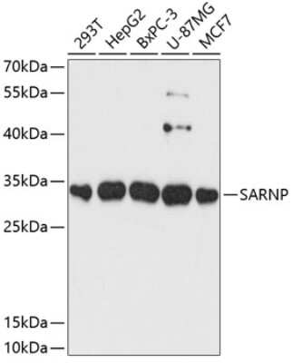 Western Blot: CIP29 Antibody [NBP2-92120] - Analysis of extracts of various cell lines, using CIP29 . Exposure time: 90s.